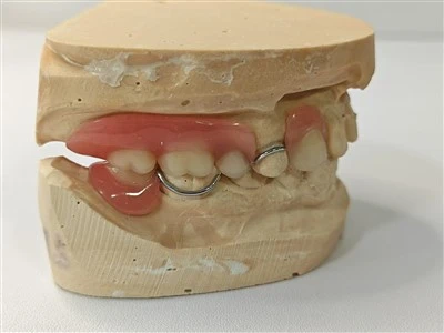 Dentario parziale in Cina con fornitori di chiusura metallica Lab