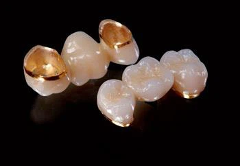 Corona dentale in oro palladio semi prezioso
